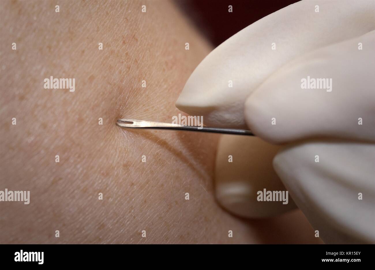 Bifurcated needle hi-res stock photography and images - Alamy