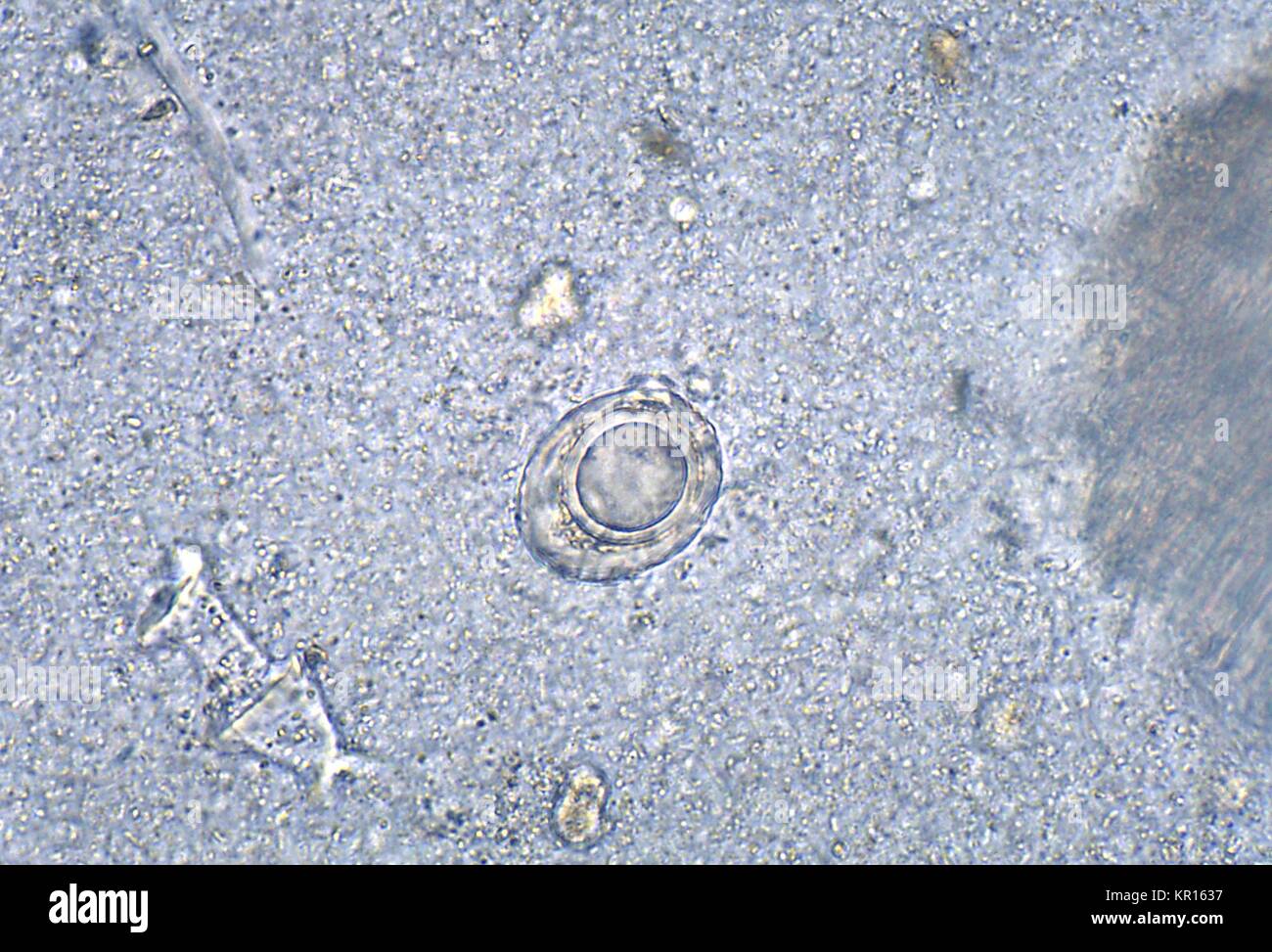 A photomicrograph of a Trichuris vulpis egg that has been removed from a dog?s intestine, 1978. T. vulpis, or 'Canine Whipworm', is a parasite that attaches itself to the canine large intestinal mucosa by embedding its head, thereby, causing intestinal inflammation. Image courtesy CDC/Dr. Mae Melvin. Stock Photo