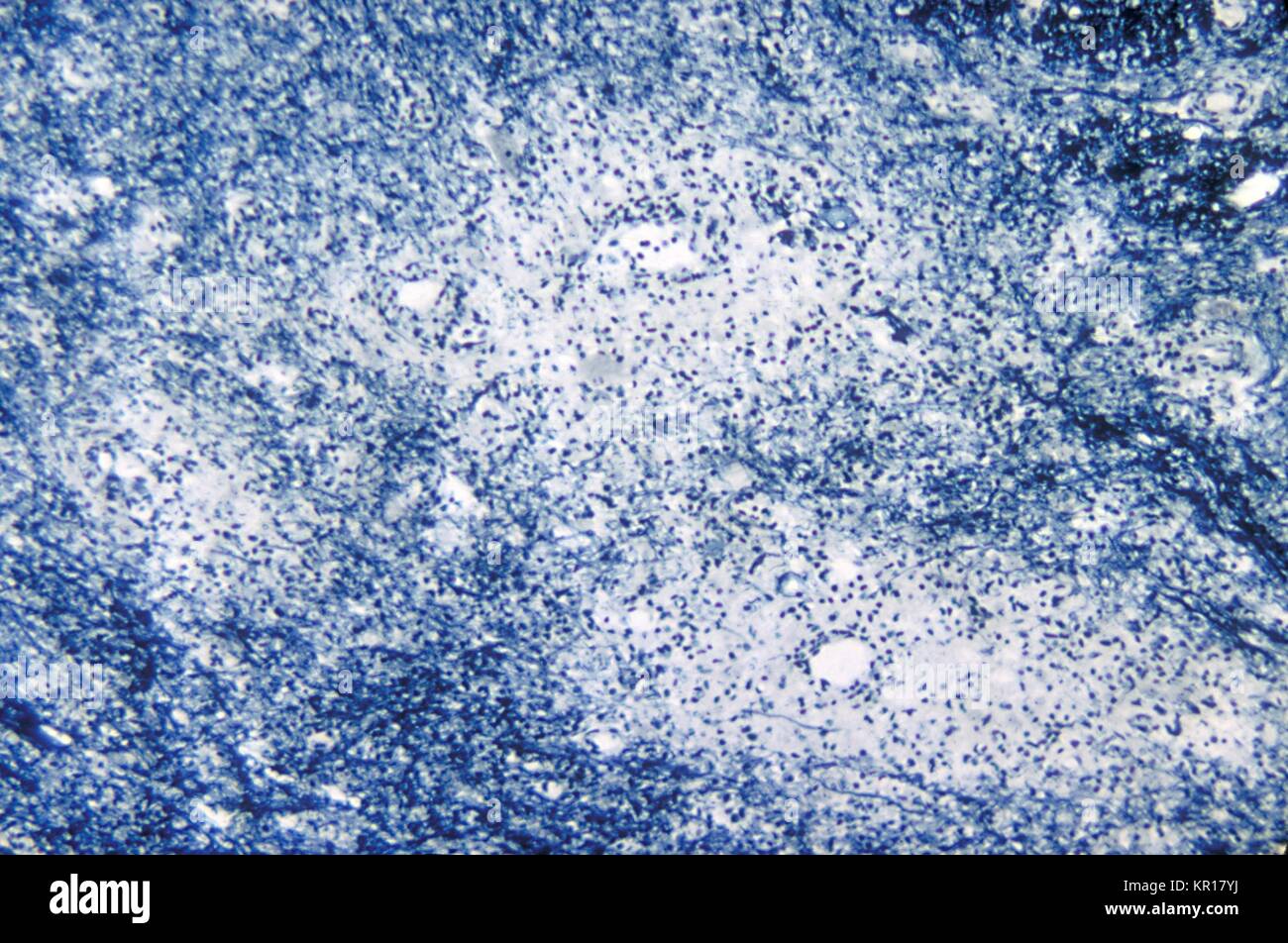 A photomicrograph of the cervical spinal cord in the region of the