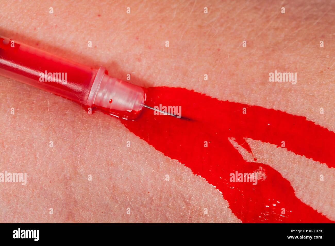 Kleine Spritze mit Nadel in der Haut Ader Vene Blut Drogen Medizin als Macro Nahaufnahme Stock Photo