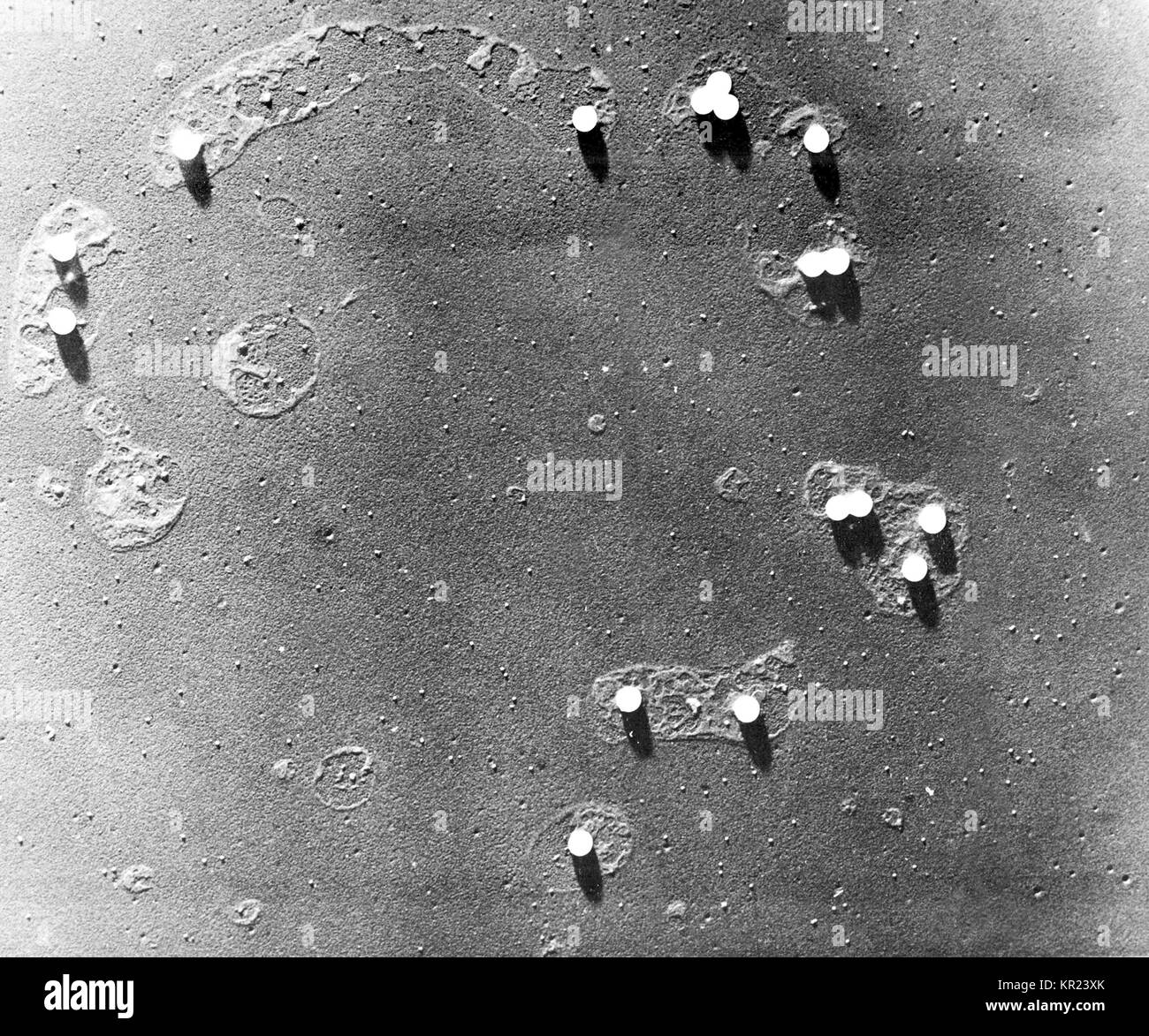 Scanning electron photomicrograph (SEM) of polio virions, 1973. The poliovirus lives in the human pharynx and intestinal tract. Poliomyelitis is an acute infection that involves the gastrointestinal tract and, occasionally, the central nervous system. It is acquired by fecal-oral transmission. Image courtesy CDC. Stock Photo