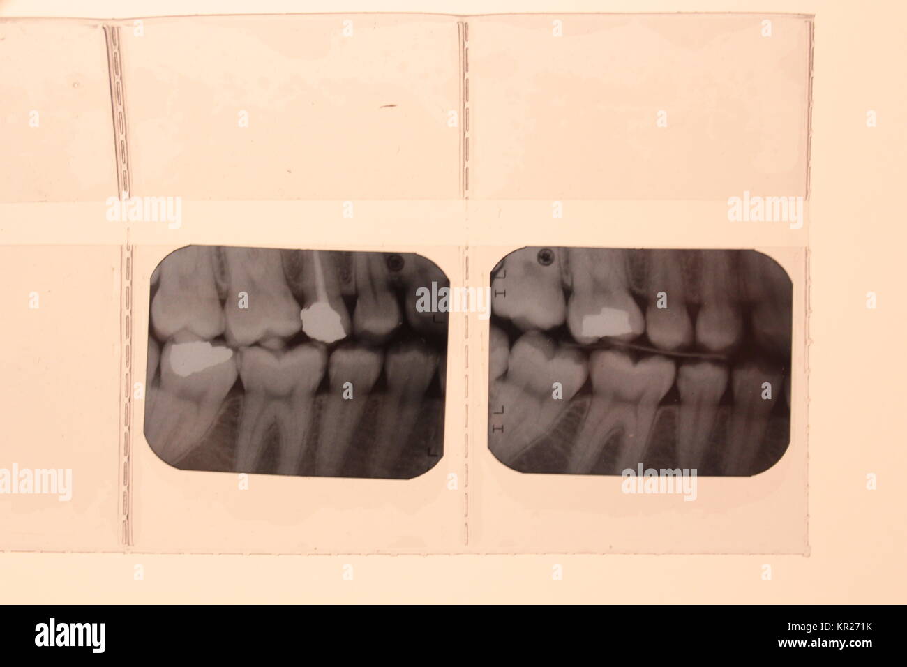 teeth radiology dentist Stock Photo Alamy