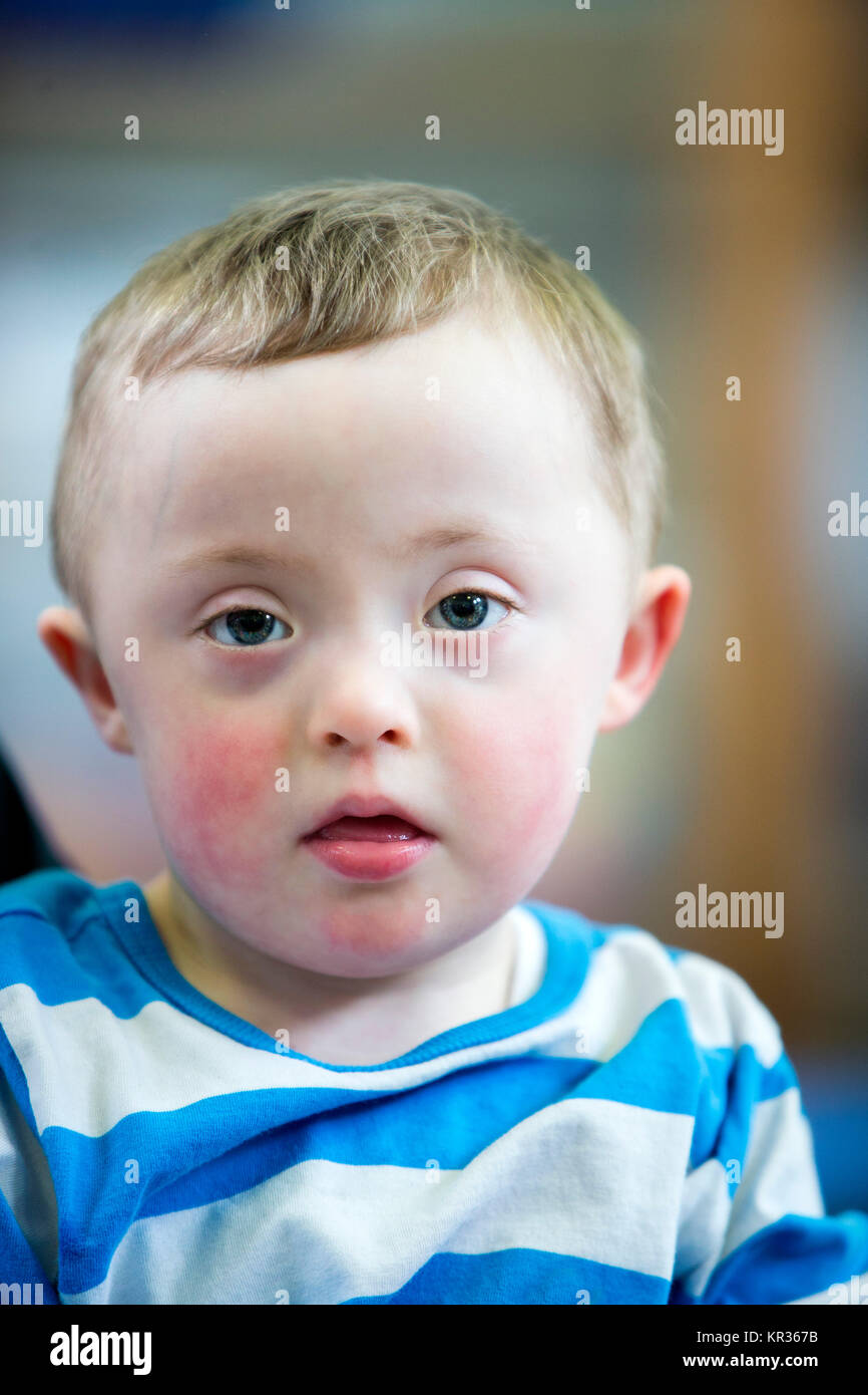 Portrait of a Down Syndrome boy. Stock Photo