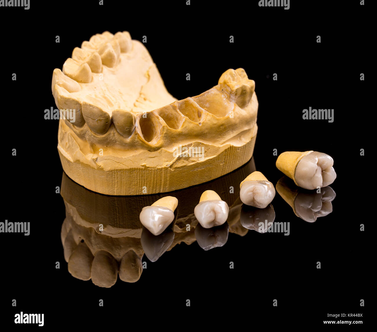 Ceramic dental implants Stock Photo Alamy