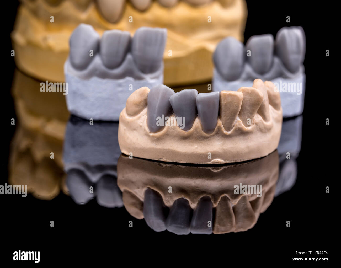 Artificial tooth hires stock photography and images Alamy