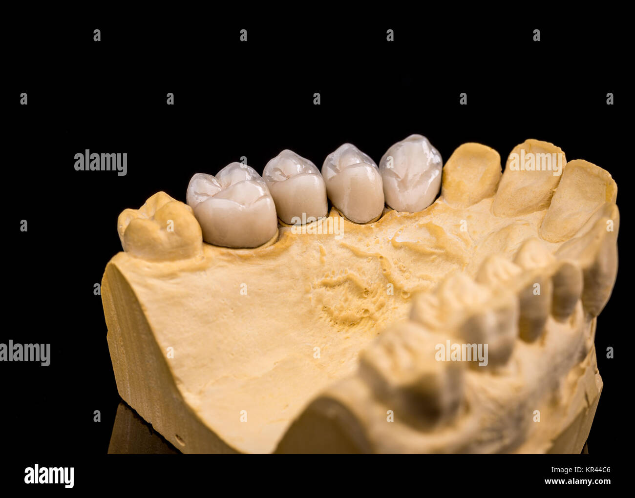 Porcelain false teeth hires stock photography and images Alamy