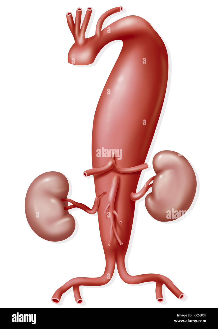 AORTIC ANEURYSM Stock Photo