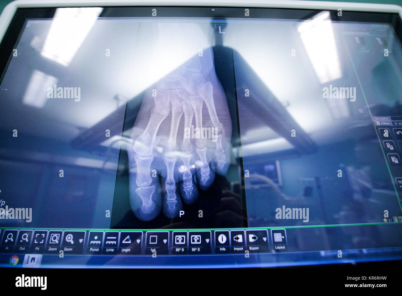 Orthopedic radiography in a surgery room in a orthopedic hospital Stock Photo Alamy