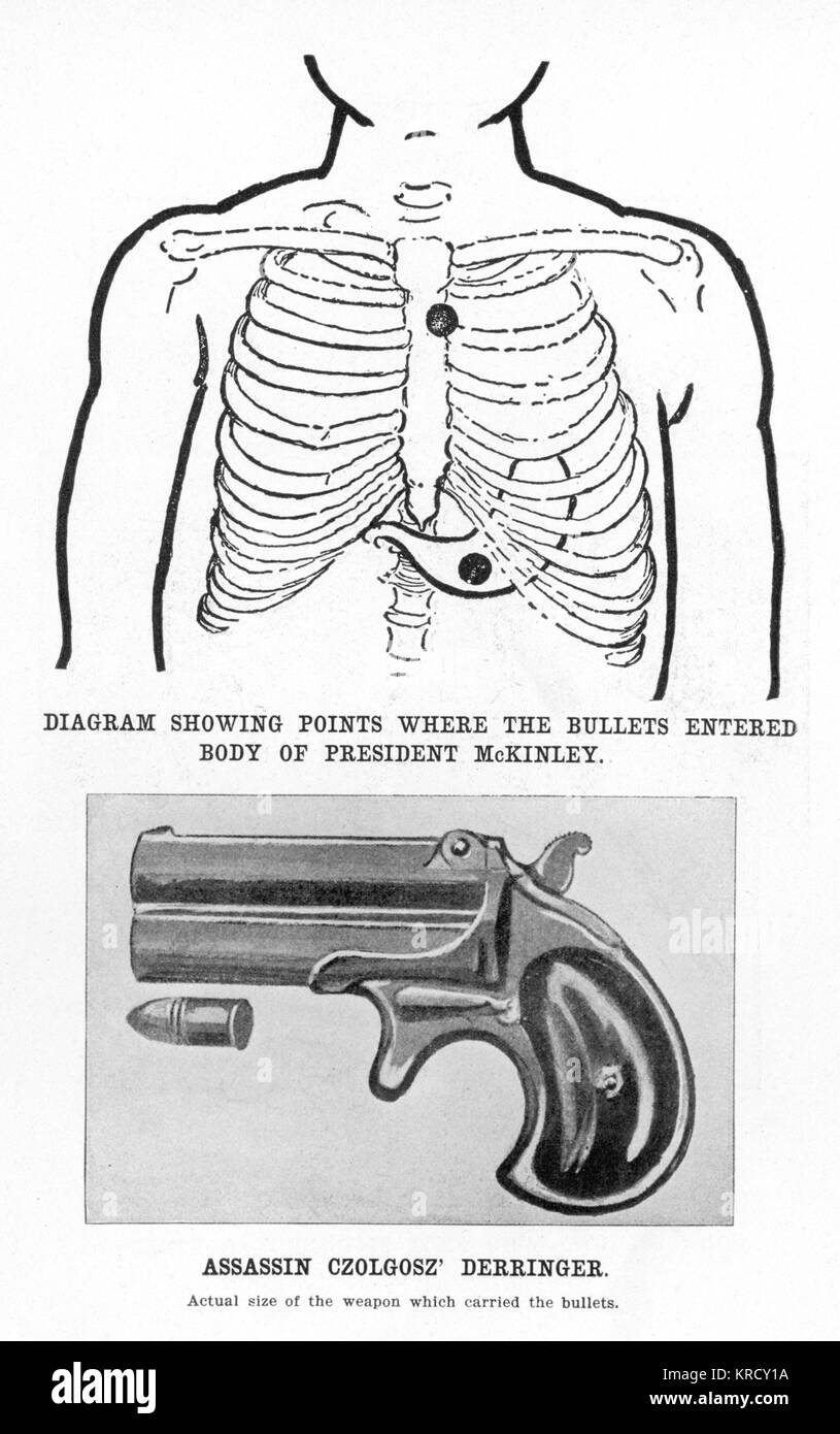 Assassin, Czolgosz' Derringer  gun and diagram showing where  the two bullets entered  President McKinley's body.        Date: 1869 - 1940 Stock Photo
