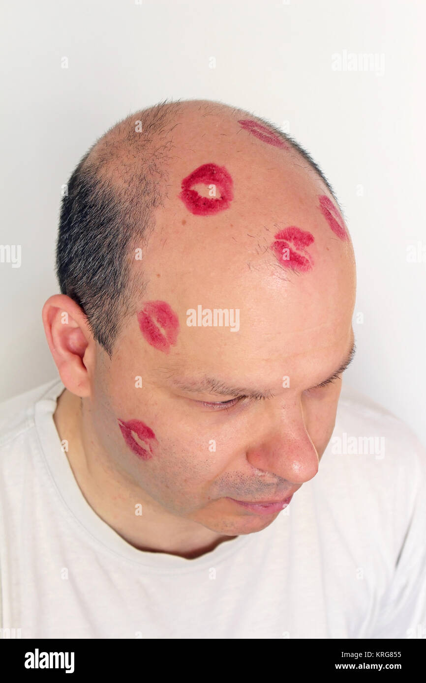 Bald man kiss marks Stock Photo