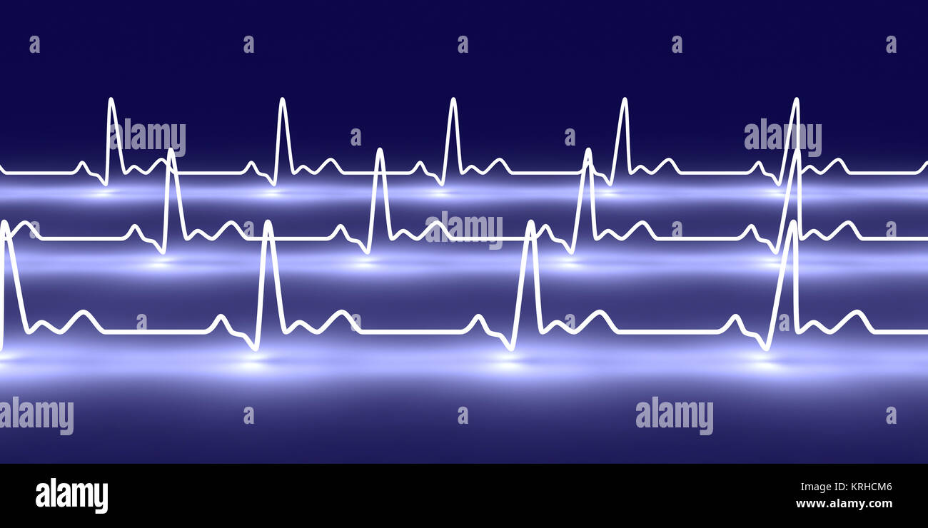 3D rendered Illustration. Heartbeat graph Stock Photo Alamy