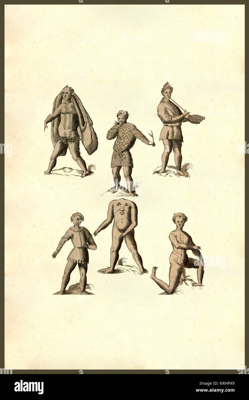 'Six people with deformities.   From the 1642 book Monstrorum Historia by Ulisse Aldrovandi  (Bologna, 1522-1605).   He is considered the founder of modern Natural History.' Stock Photo