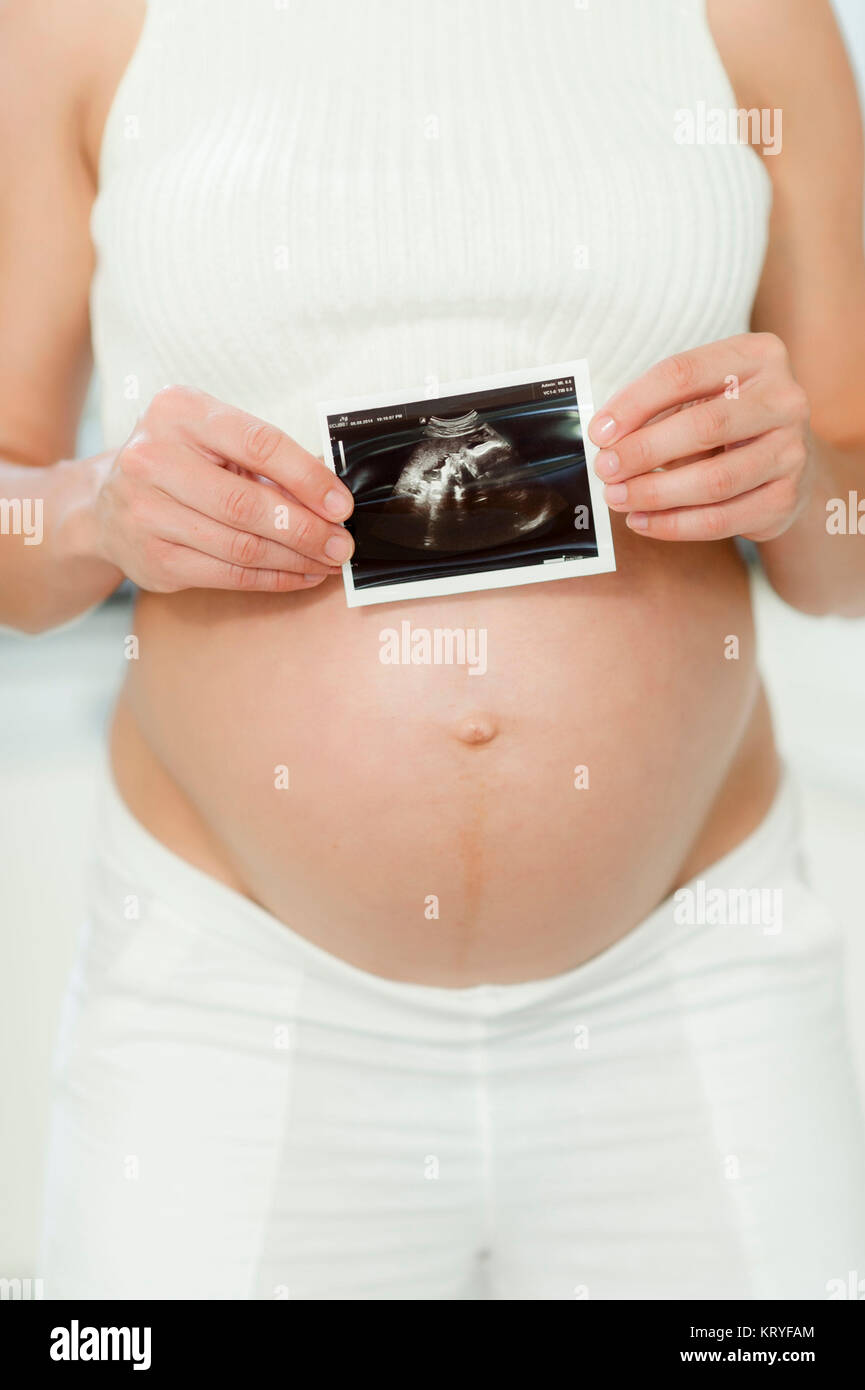 Schwangere Frau mit Ultraschallbild - pregnant woman with sonogram Stock Photo