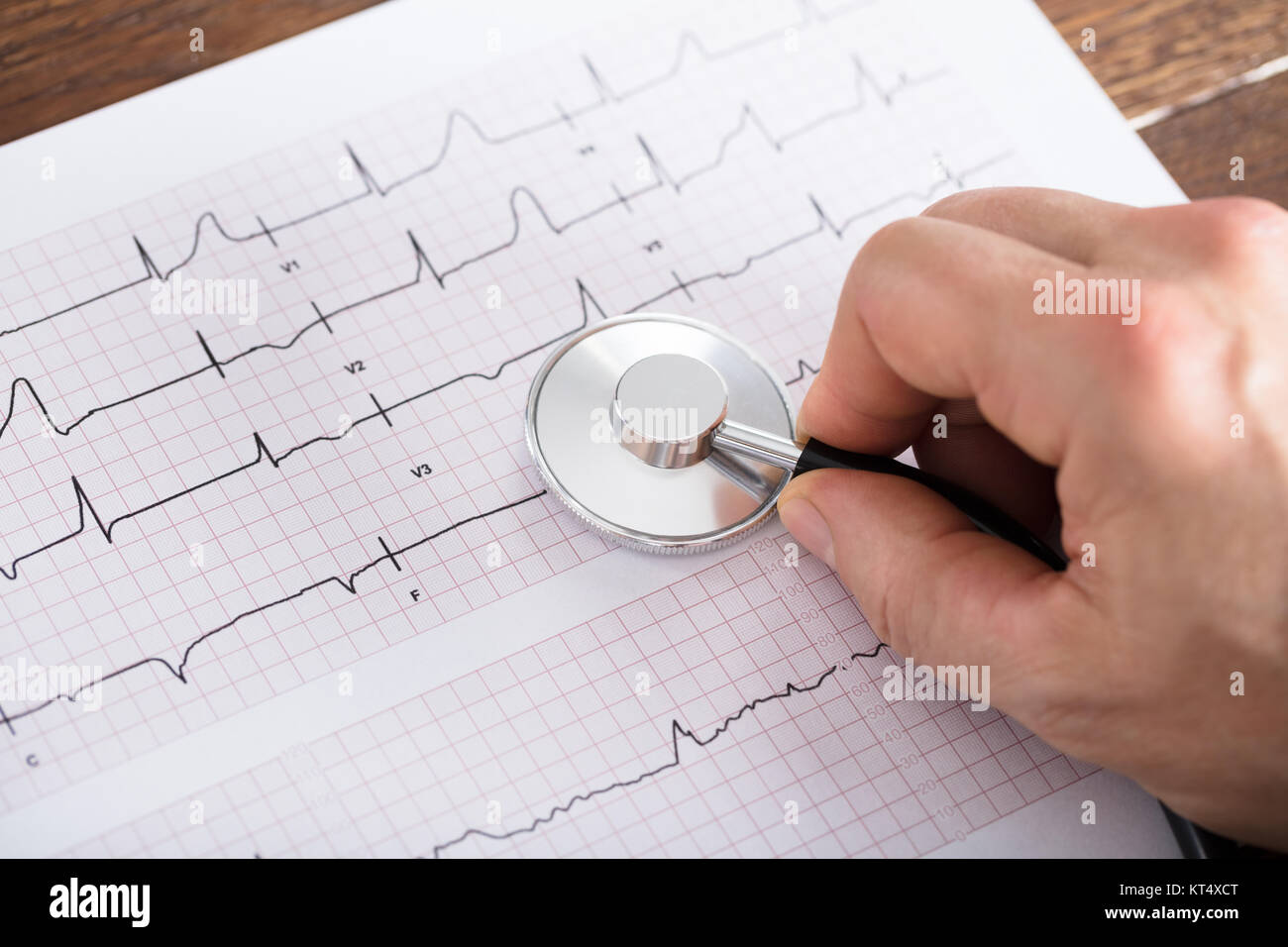 Person Hand Using Stethoscope On Cardiogram Chart Stock Photo - Alamy