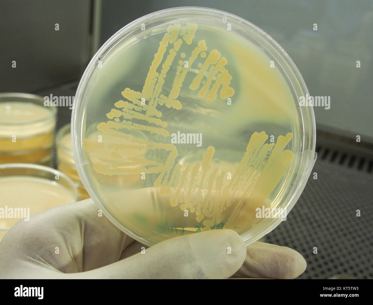 Agar plates culture closeup Stock Photo Alamy