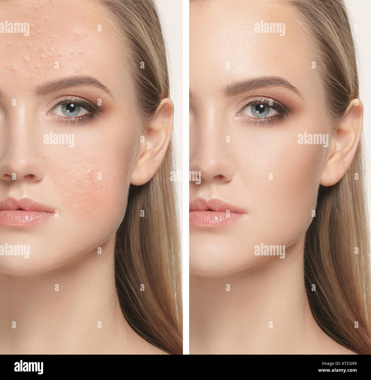Makeup before and after hi-res stock photography and images - Alamy