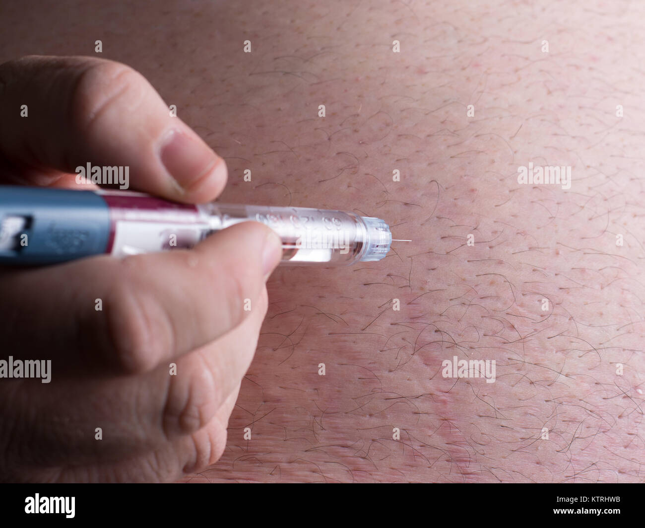 insulin being administered via an insulin pen into large mans stomach. Stock Photo