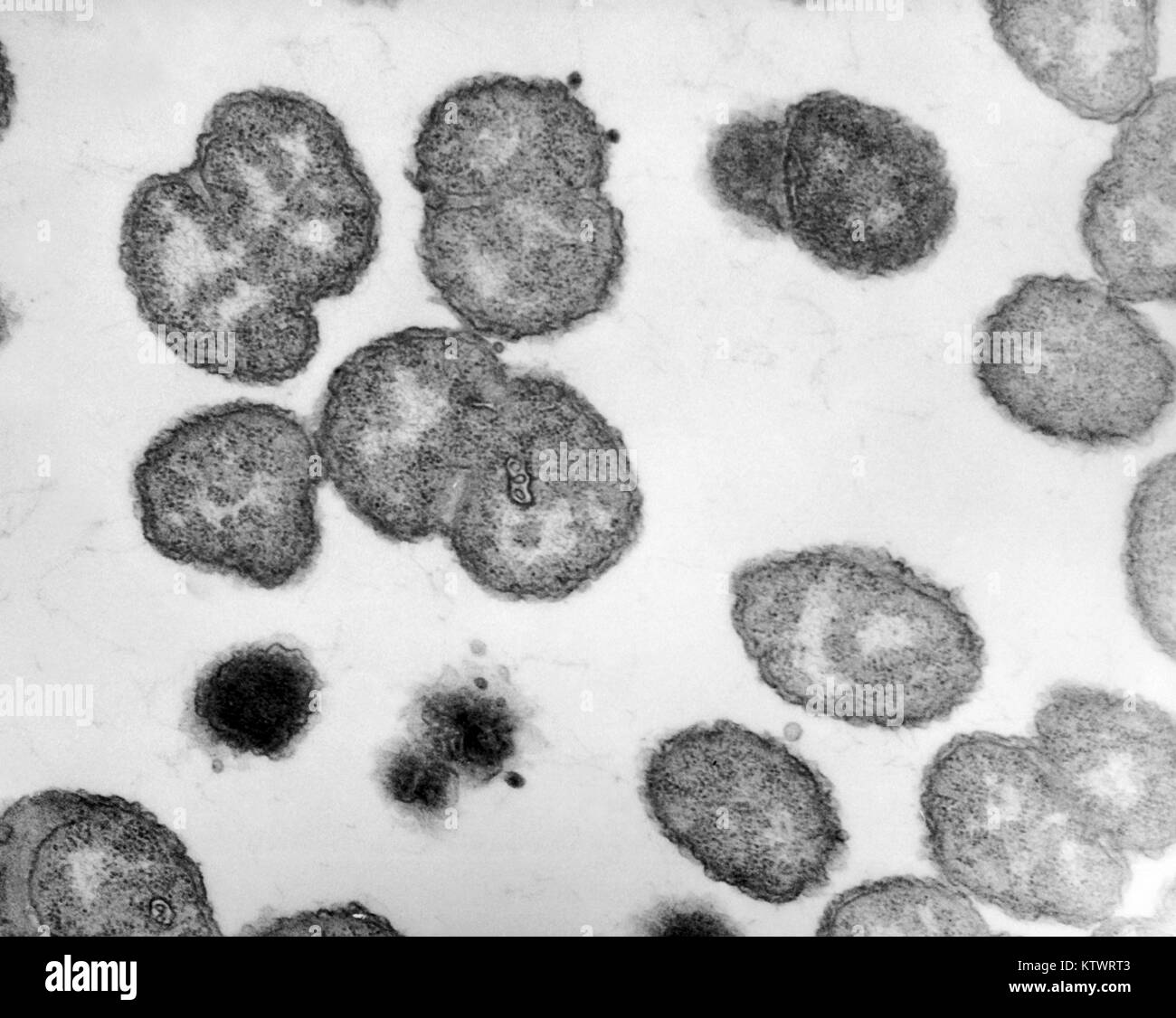 Electron micrograph of Neisseria gonorrhoeae bacteria, the causative agent of gonorrhea, magnification 100, 000X. In 2000, 358, 995 cases of gonorrhea were reported to the CDC, 1971. In the United States, approximately 75 percent of all reported cases of gonorrhea are found in younger persons aged 15 to 29 years. Image courtesy CDC, VD/SCSD. Stock Photo