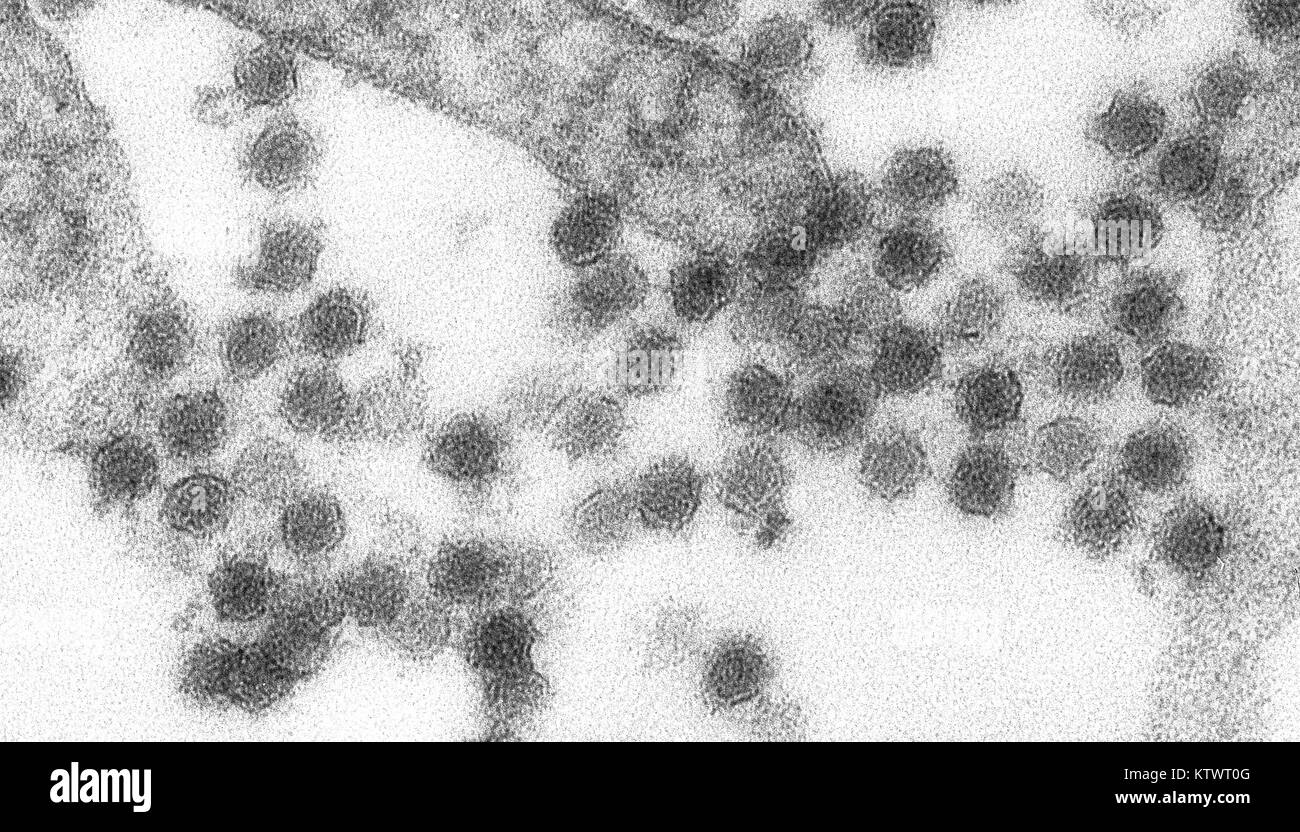 This is a transmission electron micrograph (TEM) of the West Nile virus (WNV). West Nile virus is a flavivirus commonly found in Africa, West Asia, and the Middle East, 2002. It is closely related to St. Louis encephalitis virus found in the United States. The virus can infect humans, birds, mosquitoes, horses and some other mammals. Image courtesy CDC/Cynthia Goldsmith. Stock Photo