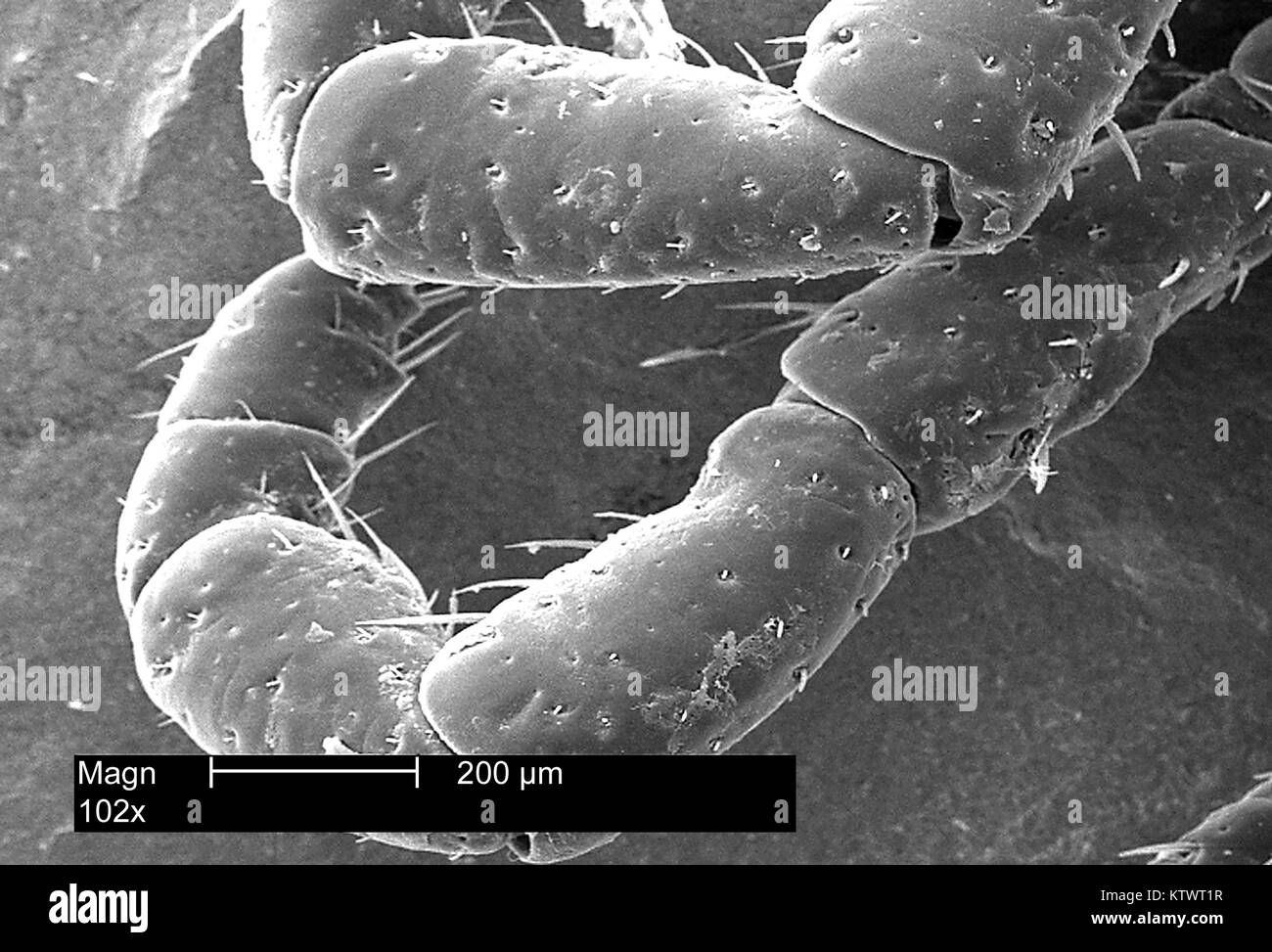 This scanning electron micrograph (SEM) depicts a dorsal view of the leg appendages of an American dog tick, Dermacentor variabilis, magnified 102X. Ticks are of the class Arachnida, as are spiders and mites, 2002. D. variabilis is a known carrier of Rocky Mountain Spotted Fever caused by the bacterium Rickettsia rickettsii . Image courtesy CDC. Stock Photo
