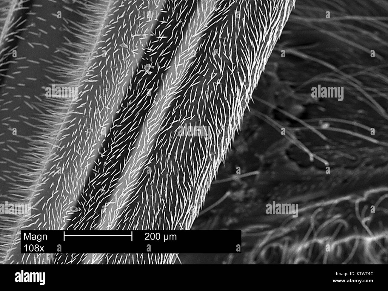 This is a scanning electron micrograph (SEM) of a wasp's leg appendage revealing small, highly sensitive hairs on its surface magnified 108X. Known as setae, these hairs act to increase the levels of sensitivity experienced by the wasp to environmental conditions such as wind direction, moisture, and temperature. Image courtesy CDC, 2002. Stock Photo