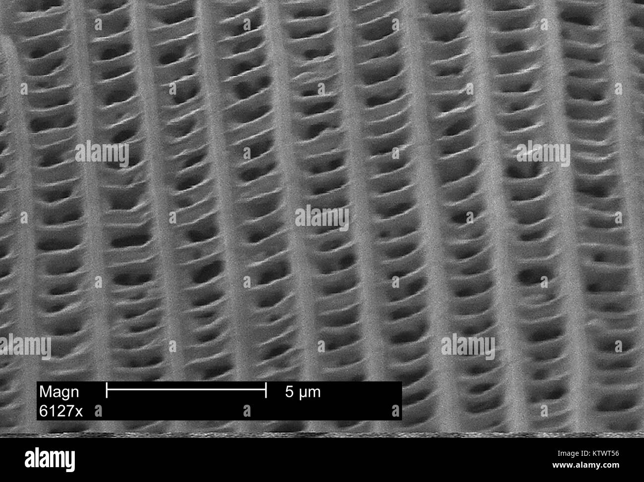This scanning electron micrograph (SEM) depicts the strut-like construction of a single scale from a butterfly's wing, magnified 6127X. Note the struts and perforations of the individual scale. This helps to promote heightened aerodynamic lift during the insect's flight, as well as reduce the weight of the wing mechanism. Image courtesy CDC, 2002. Stock Photo