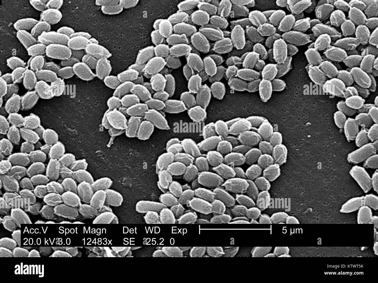 Under a high magnification of 12, 483X, this scanning electron micrograph (SEM) depicted spores from the Sterne strain of Bacillus anthracis bacteria. For a black and white version of this image see PHIL 10122. A key characteristic of the Sterne strain of B. anthracis is the wrinkled surface of the protein coat of these bacterial spores. These spores can live for many years which, enables the bacteria to survive in a dormant state. Image courtesy CDC/Laura Rose, 2002. Stock Photo
