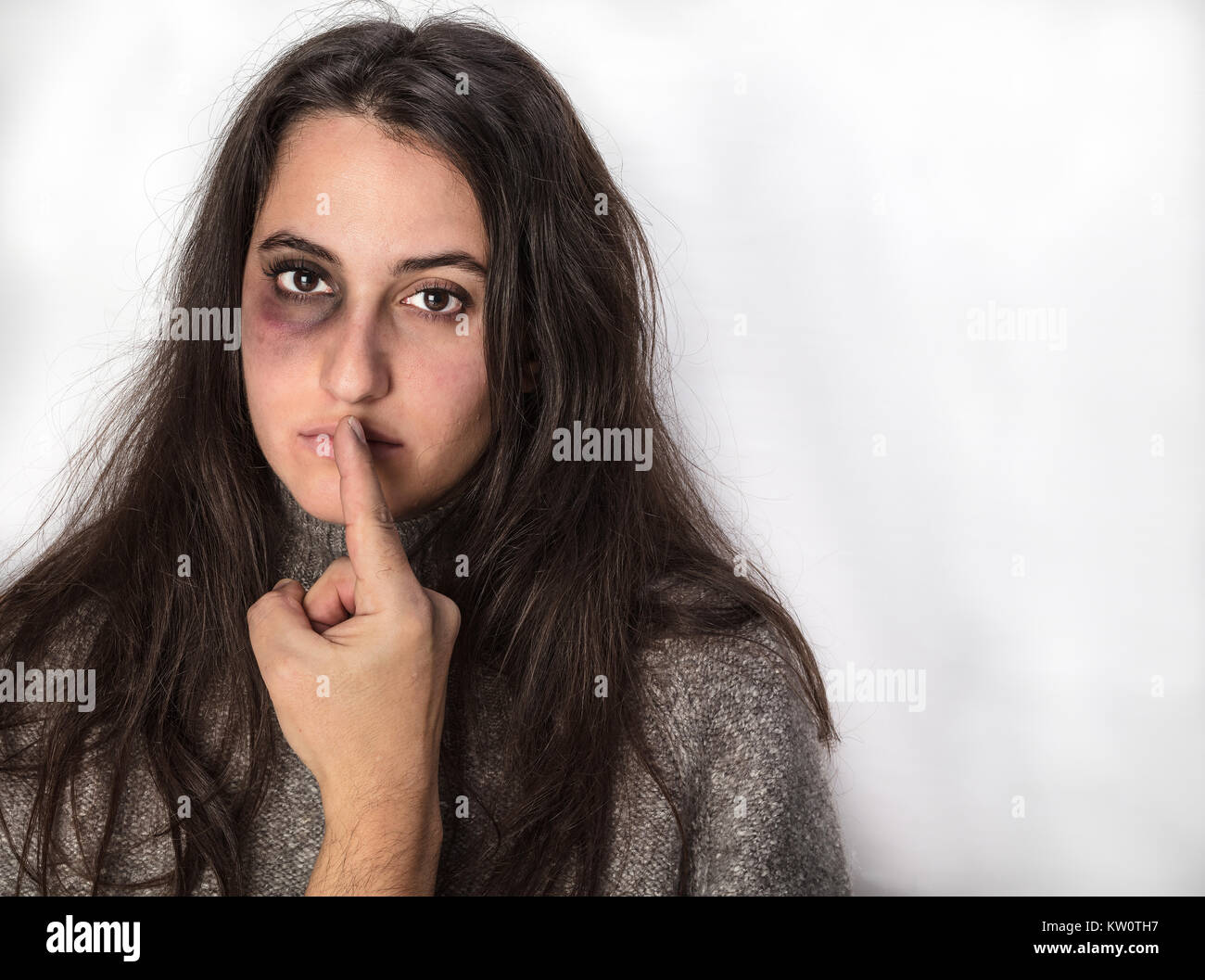 Woman With Black Eye