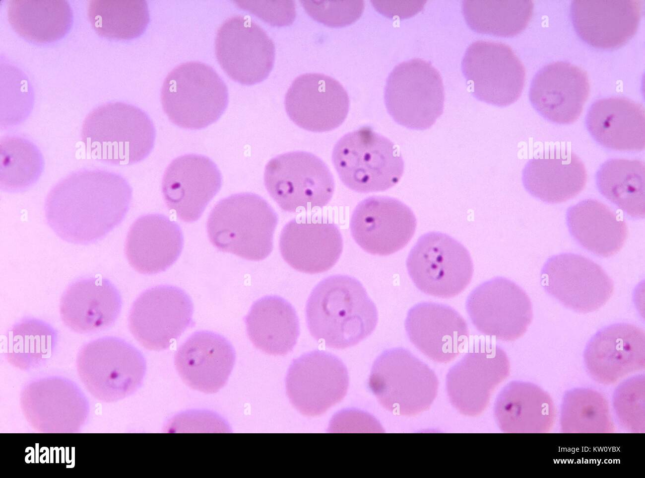 Photomicrograph Of A Blood Smear Showing Plasmodium Falciparum Rings Photomicrograph Of A Blood Smear Showing Plasmodium Falciparum Rings