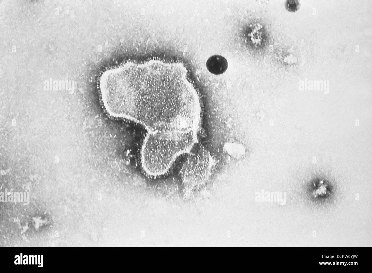 This transmission electron micrograph (TEM) reveals the morphologic traits of the Respiratory Syncytial Virus (RSV). The virion is variable in shape, and size (average diameter of between 120-300nm). RSV is the most common cause of bronchiolitis and pneumonia among infants and children under 1 year of age. Image courtesy CDC/E. L. Palmer, 1981. Stock Photo