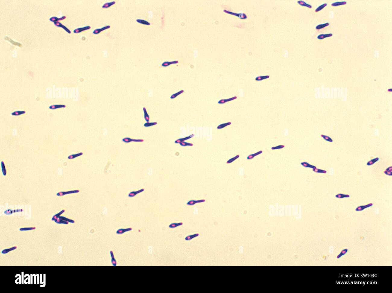 Clostridium Gram Stain Morphology