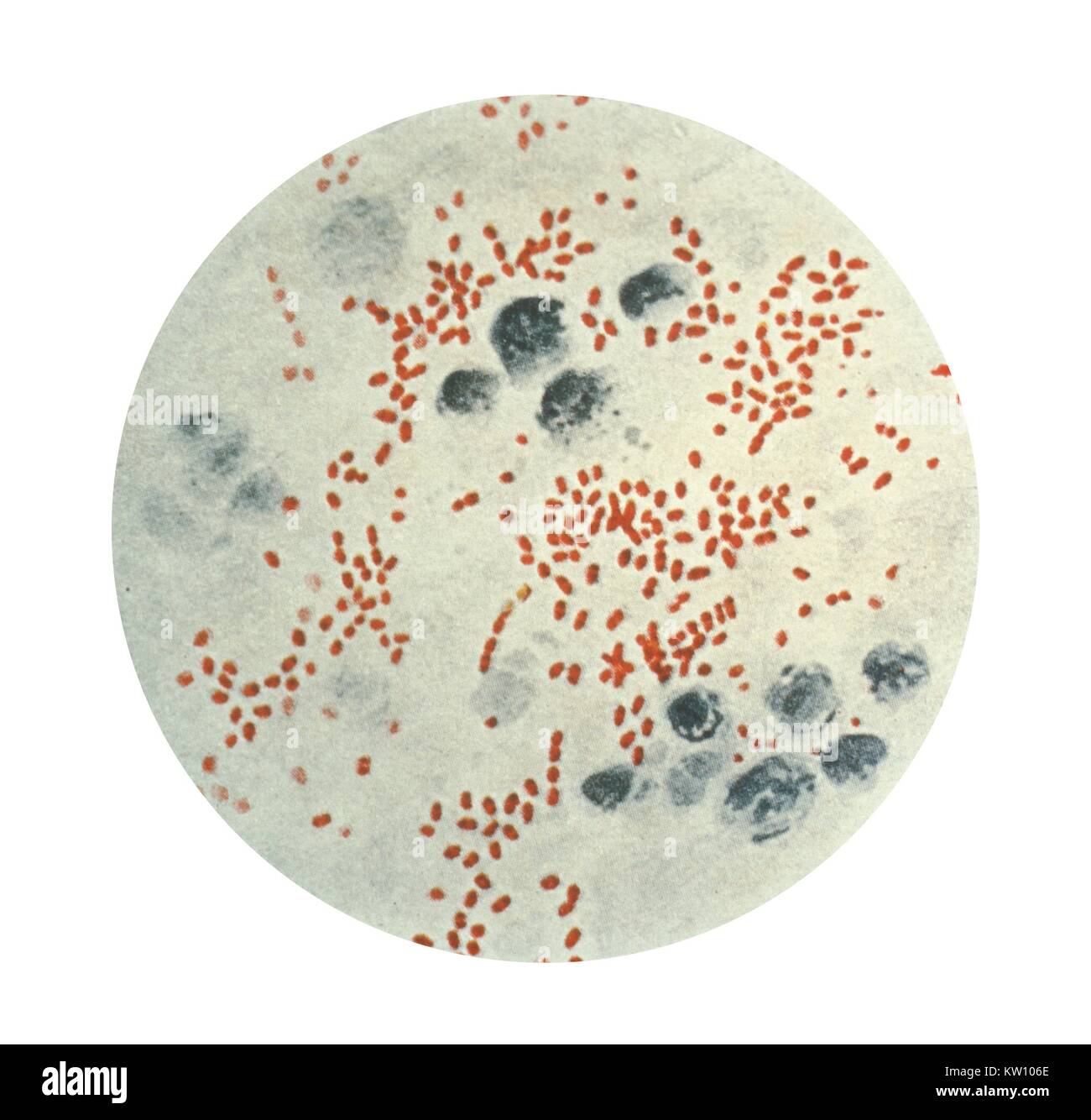 This illustration depicts a photomicrograph of Yersinia (Pasteurella) pestis, sometimes referred to as Bacillus pestis, bacteria. Yersinia pestis causes plague in animals and humans. People usually get plague from being bitten by a rodent flea that is carrying the plague bacterium, or by handling an infected animal. Image courtesy CDC. 1975. Stock Photo