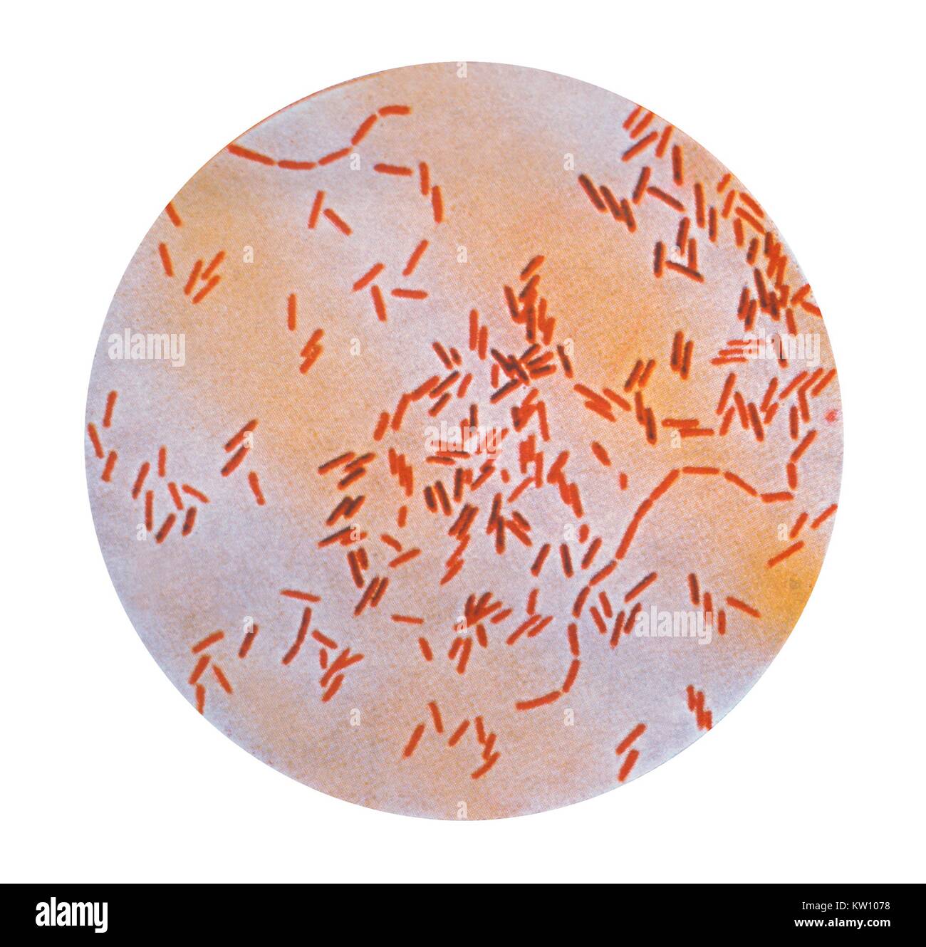 This illustration depicts a photomicrograph of Salmonella typhi bacteria using a Gram-stain technique. Salmonella typhi, also known as Eberthella typhi and Bacillus typhosus, is the cause of Typhoid fever. This life threatening disease is characterized by fever, headache, malaise, anorexia, splenomegaly, and a relative bradycardia. Image courtesy CDC, 1979. Stock Photo