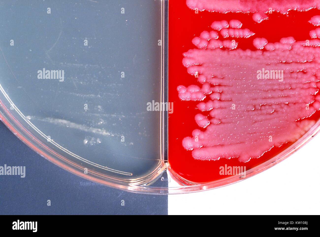 Bacillus anthracis positive encapsulation test is demonstrated using two different agar media. Note the presence of rough colonies on the blood agar medium (right), and smooth colonies on the bicarbonate agar medium (left) . Image courtesy CDC/Dr. James Feeley, 1980. Stock Photo