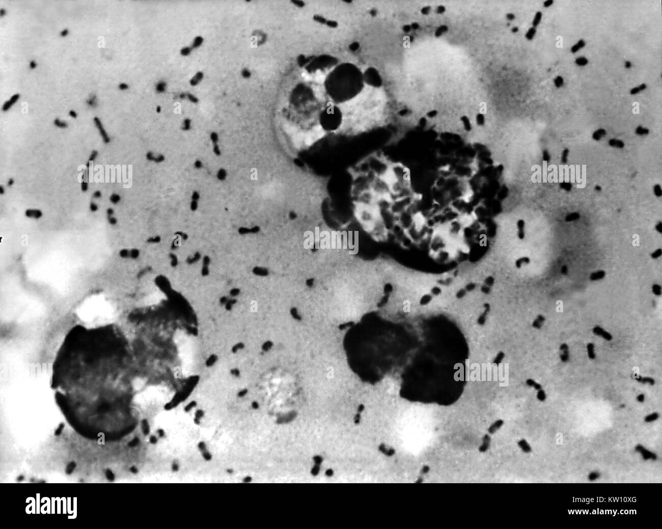 Yersinia pestis bacteria Black and White Stock Photos & Images - Alamy