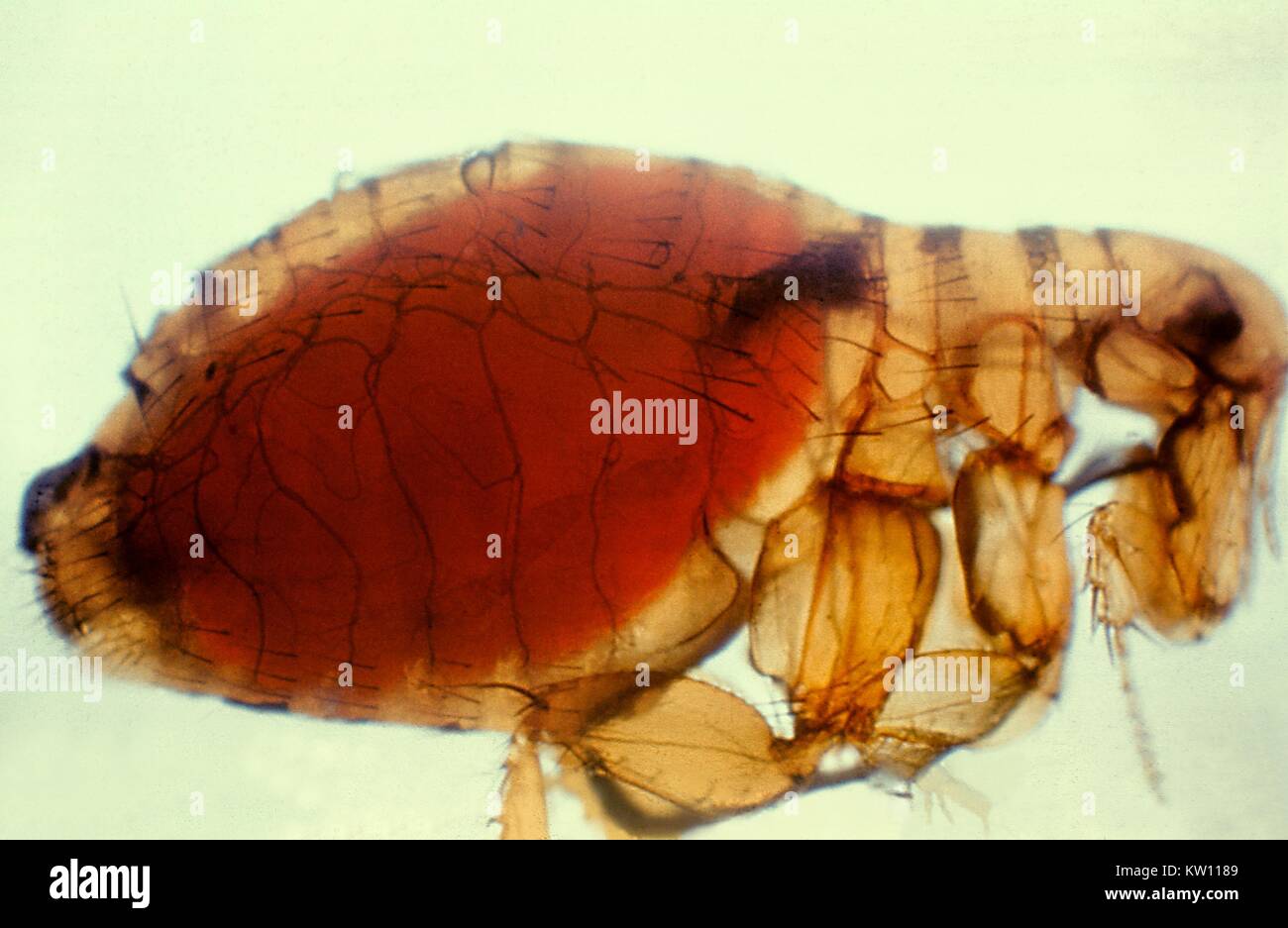 Xenopsylla cheopis, Oriental rat flea, with a proventricular plague mass. During feeding, the flea draws viable Y. pestis organisms into its esophagus, which multiply and block the proventriculus just in front of the stomach, later forcing the flea to regurgitate infected blood unto the host when it tries to swallow. Image courtesy CDC. 1981. Stock Photo