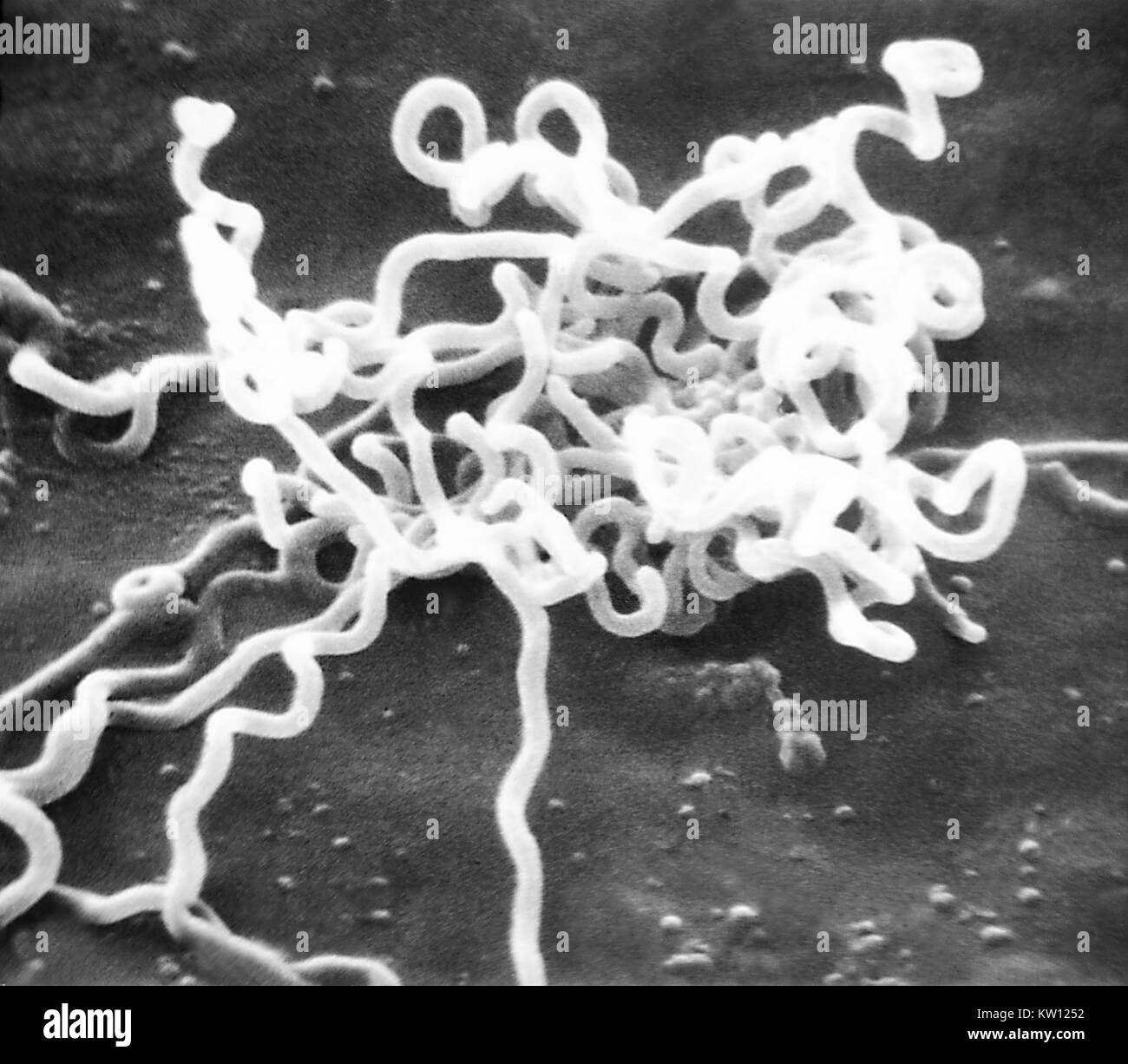Electron micrograph of Treponema pallidum on cultures of cotton-tail rabbit epithelium cells (Sf1Ep). Treponema pallidum is the causative agent of syphilis. In the United States, over 35, 600 cases of syphilis were reported by health officials in 1999. Image courtesy CDC/Dr. David Cox, 1980. Stock Photo
