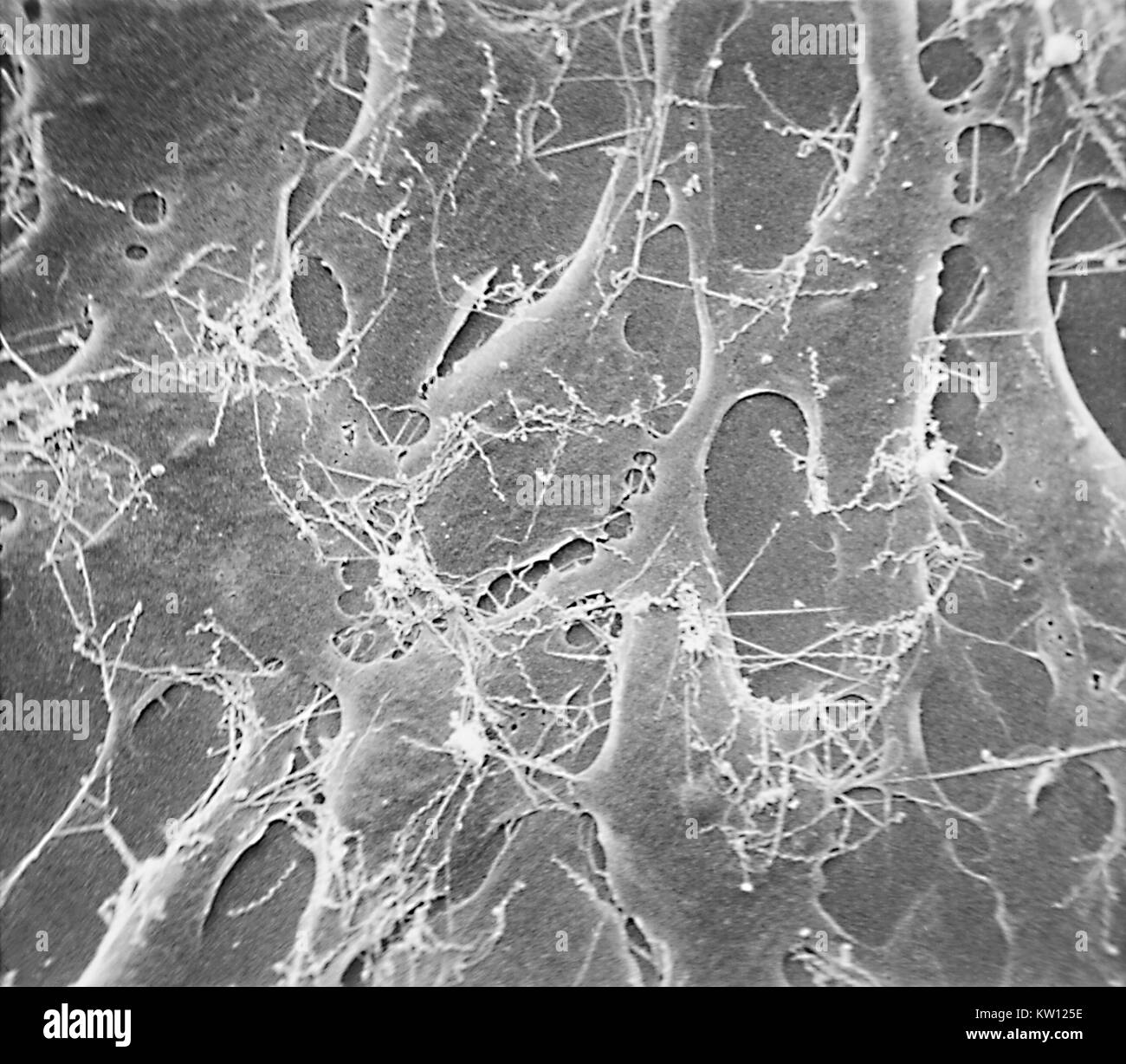 Electron micrograph of Treponema pallidum on cultures of cotton-tail rabbit epithelium cells (Sf1Ep). Treponema pallidum is the causative agent of syphilis. In the United States, over 35, 600 cases of syphilis were reported by health officials in 1999. Image courtesy CDC/Dr. David Cox, 1980. Stock Photo
