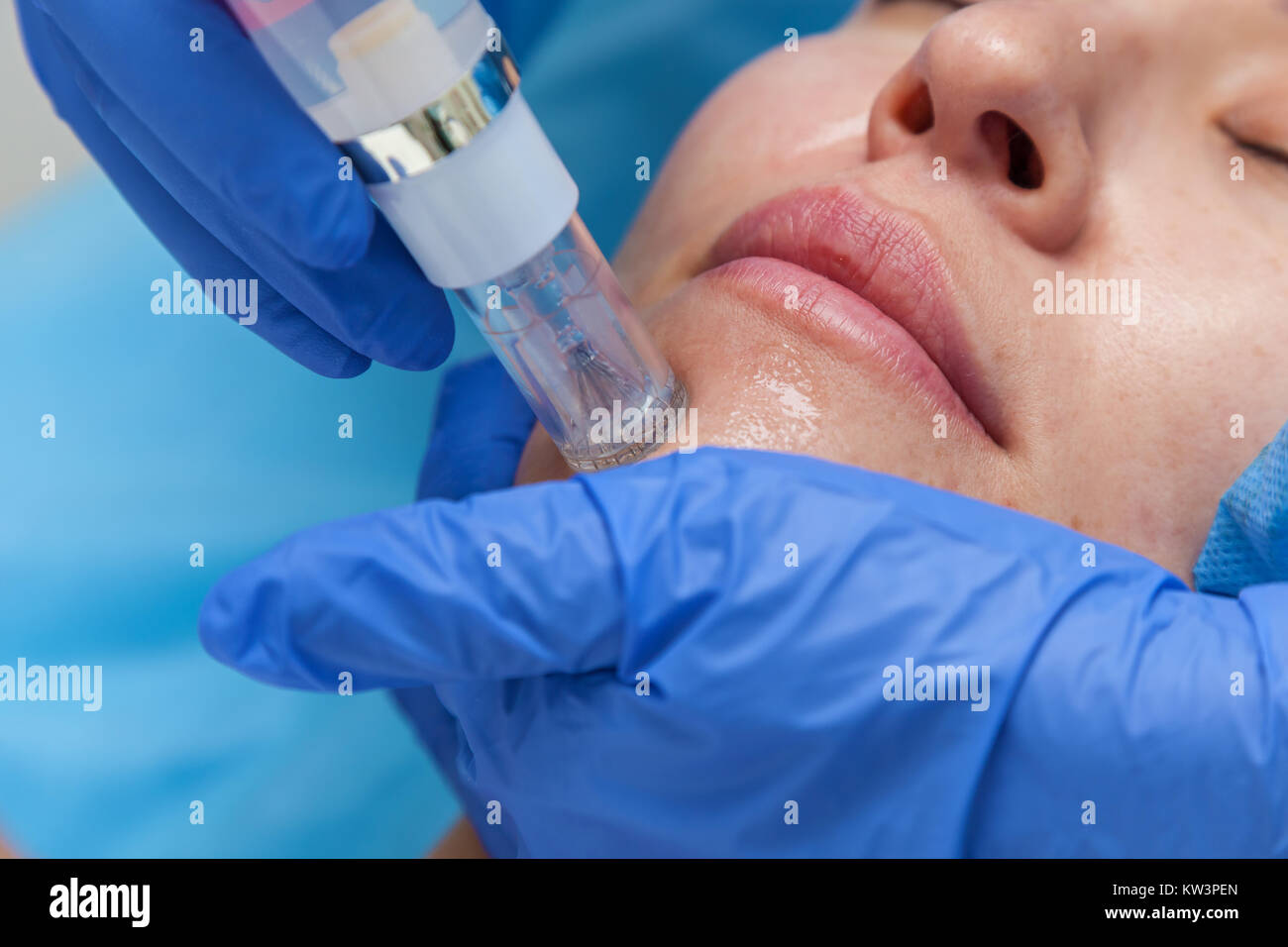 Placental injection hires stock photography and images Alamy