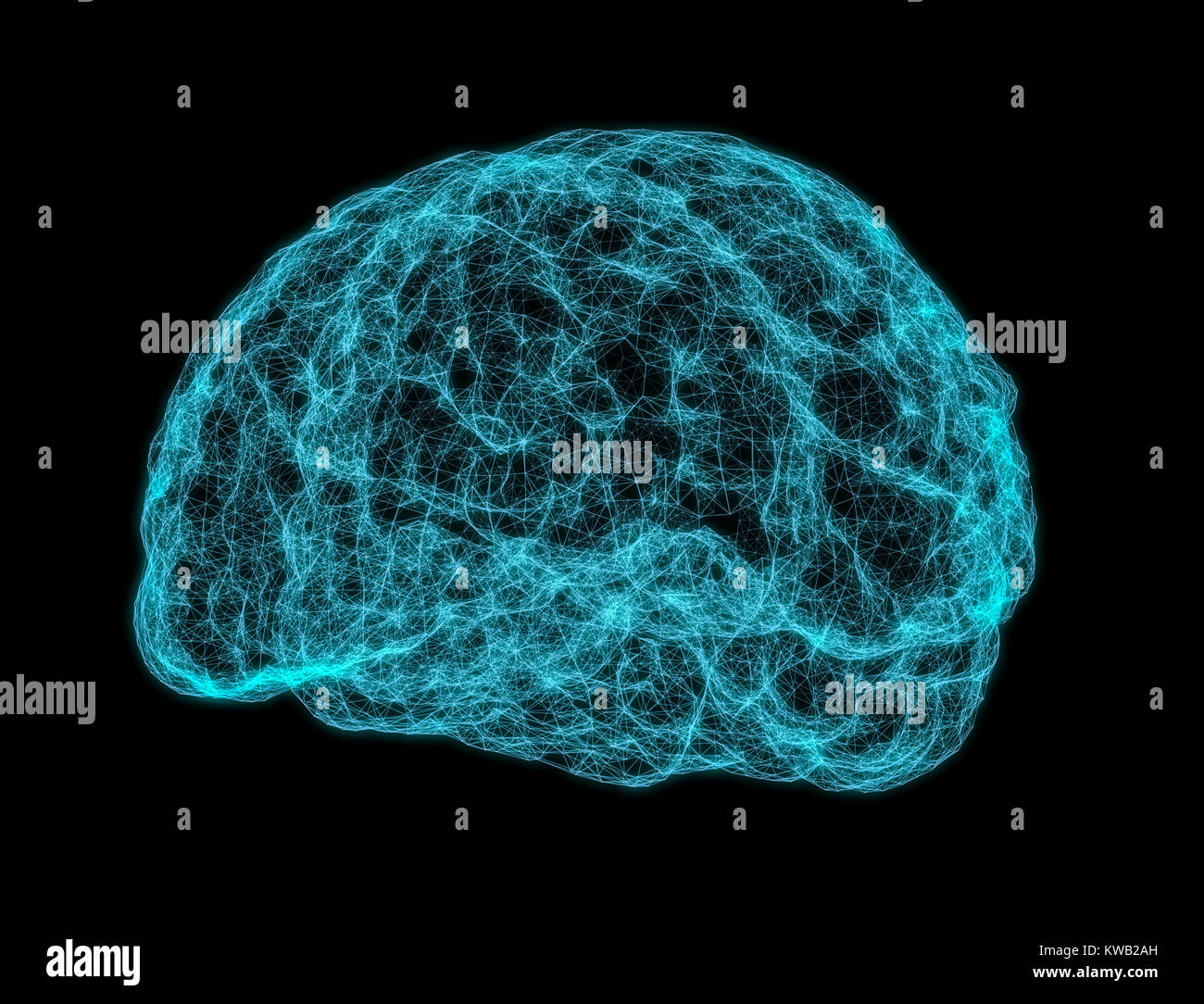 X-ray image of human brain Stock Photo - Alamy