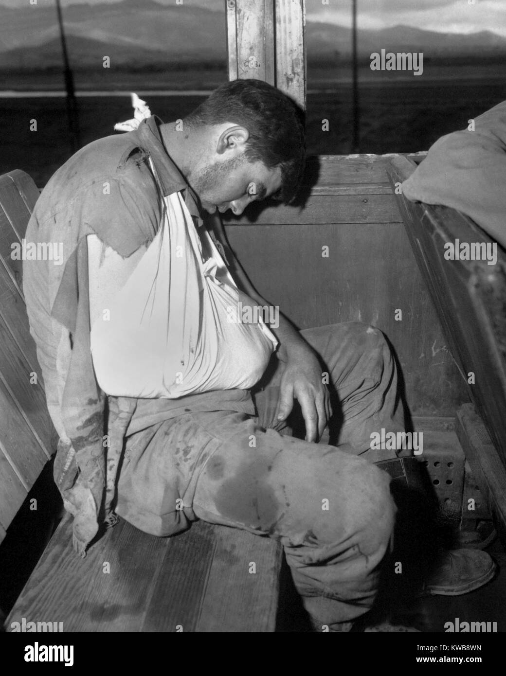 U.S. soldier wounded by enemy mortar fire on front lines during in South Korea. He is on a hospital train bound for Pusan on July 29, 1950. Korean War, 1950-53. (BSLOC 2014 11 19) Stock Photo