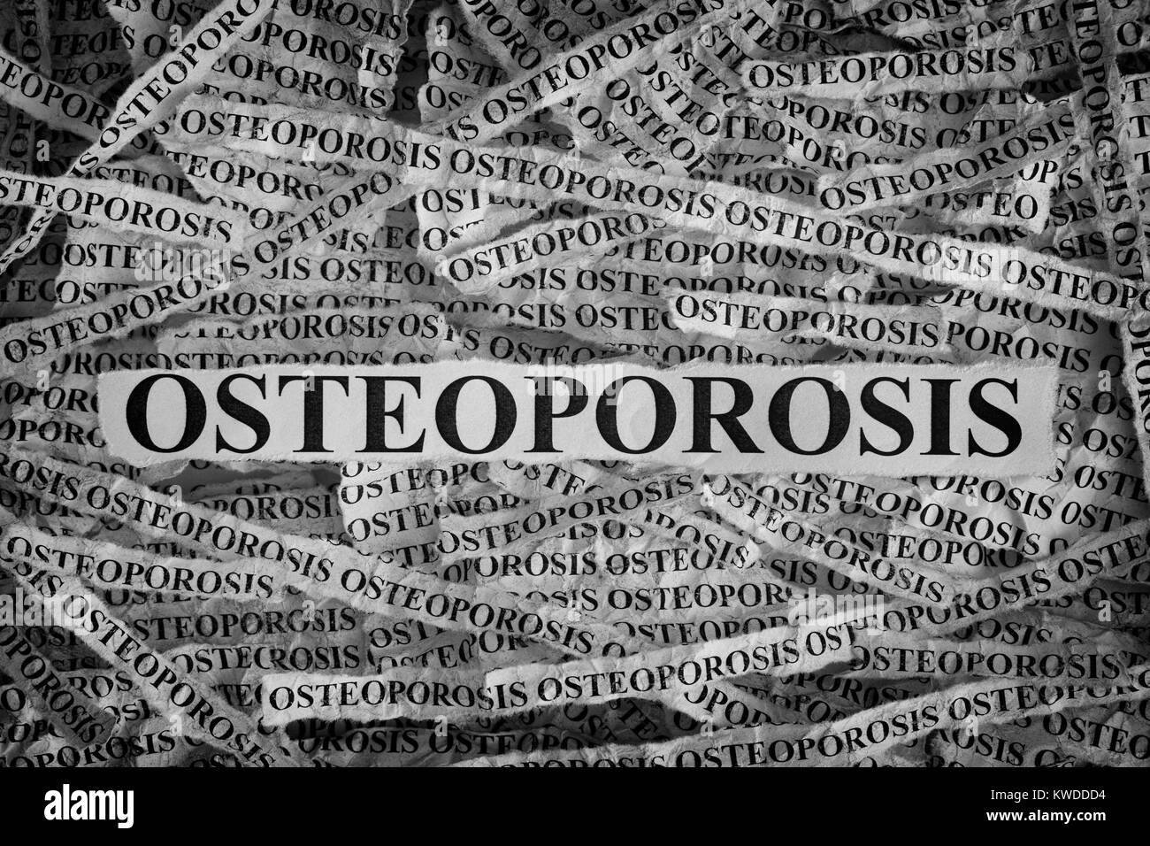 Image of osteoporosis hires stock photography and images Alamy