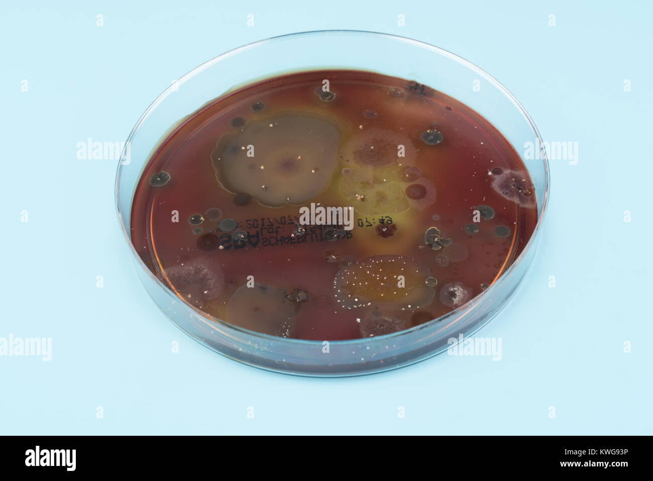 growth of in a Petri dish, Bacteria, yeast and mold