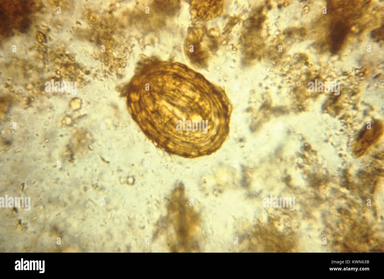 roundworm eggs in humans