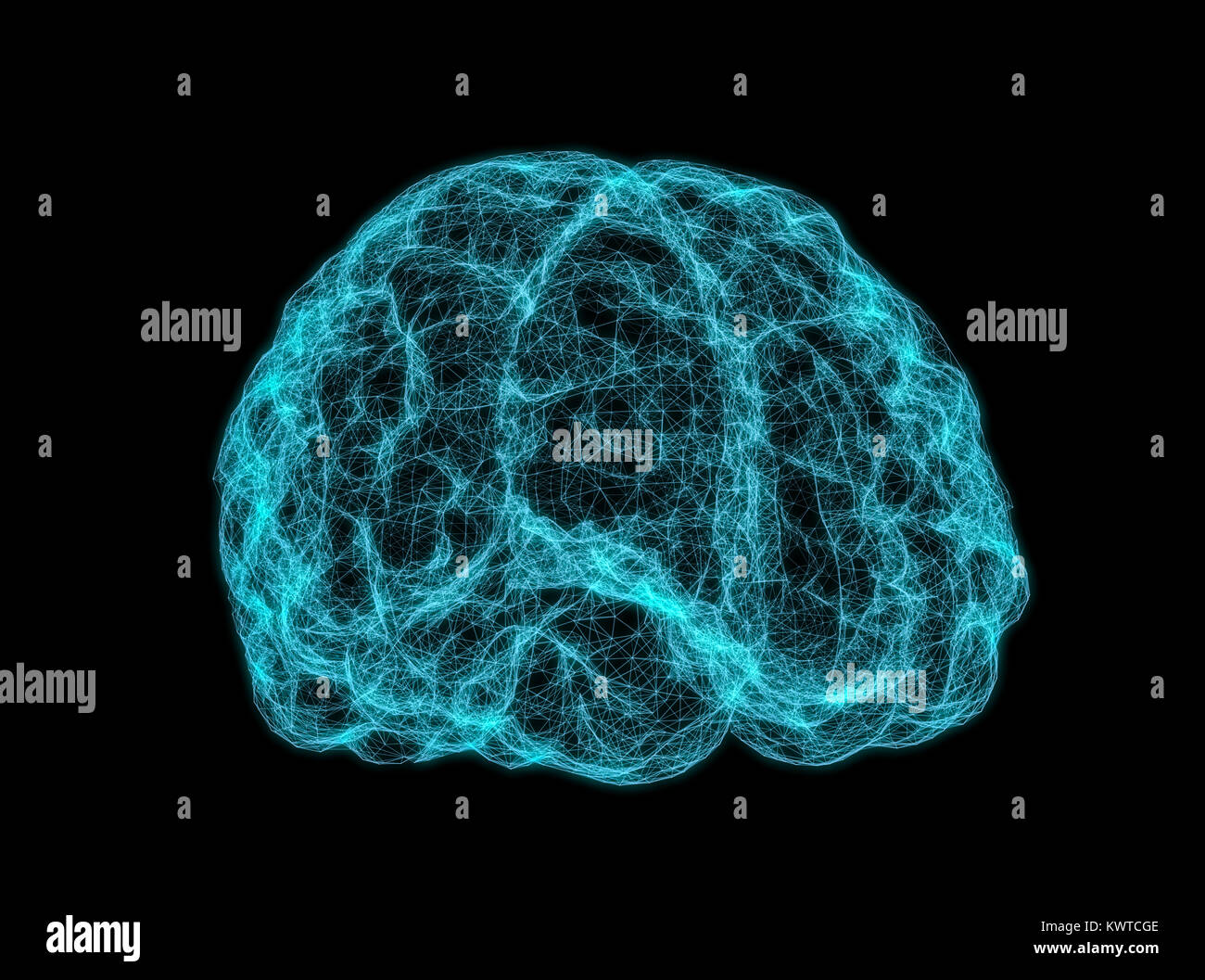 X-ray image of human brain Stock Photo - Alamy