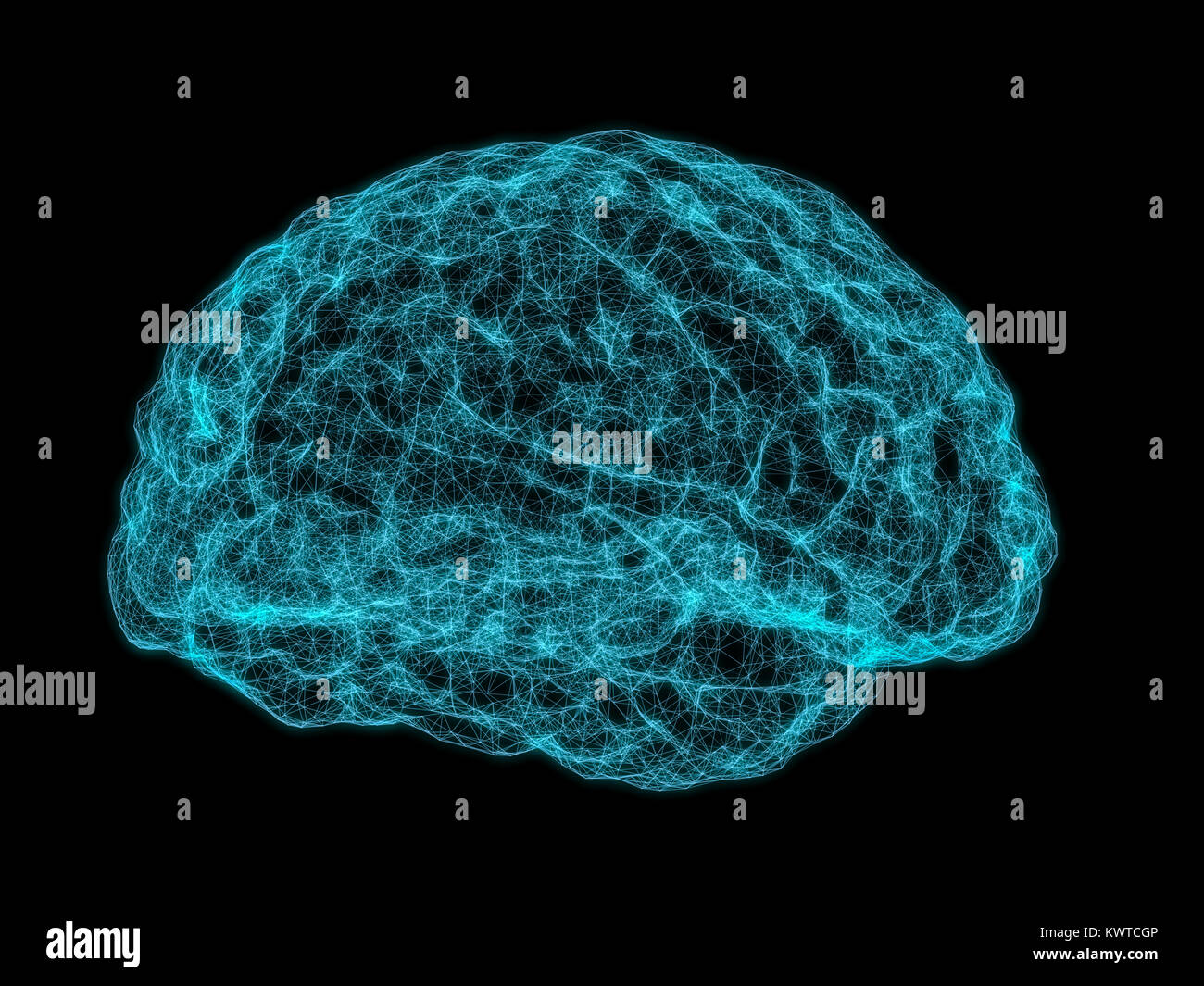 X-ray image of human brain Stock Photo - Alamy
