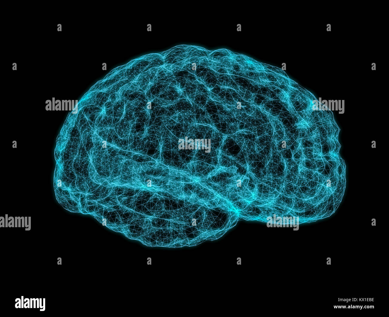 X-ray image of human brain Stock Photo - Alamy