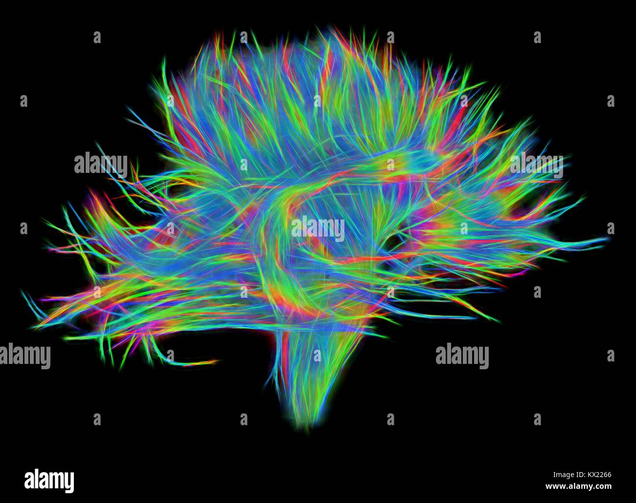 White matter fibres. Computer enhanced 3D diffusion spectral imaging (DSI) scan of the bundles of white matter nerve fibres in the brain. The fibres transmit nerve signals between brain regions and between the brain and the spinal cord. Diffusion spectrum imaging (DSI) is a variant of magnetic resonance imaging (MRI) in which a magnetic field maps the water contained in neuron fibers, thus mapping their criss-crossing patterns. A similar technique called diffusion tensor imaging (DTI) is also used to explore neural data of white matter fibres in the brain. Both methods allow mapping of their Stock Photo