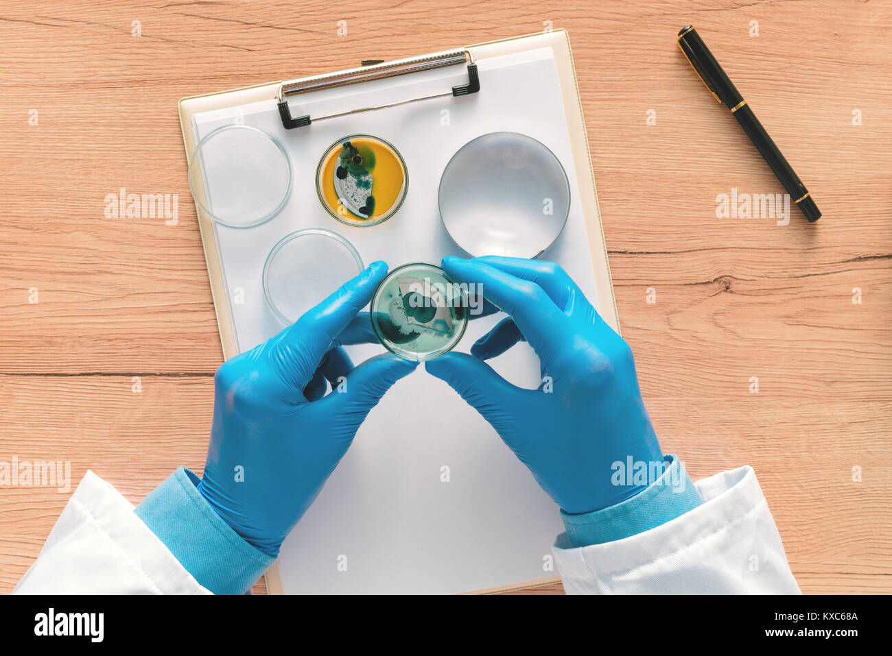 Overhead view of laboratory technician analyzing growing bacterial cultures in petri dish, science and microbiology background Stock Photo