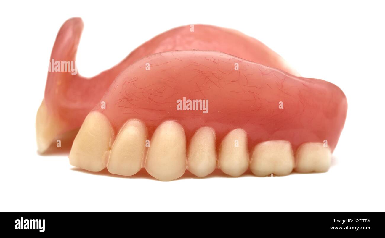 Upper partial denture Stock Photo